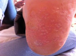 After the second marigold treatment