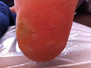 After the fourth marigold treatment