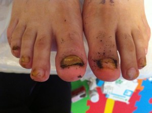 first-treatment-marigold