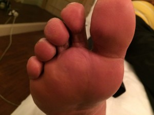 toe 2